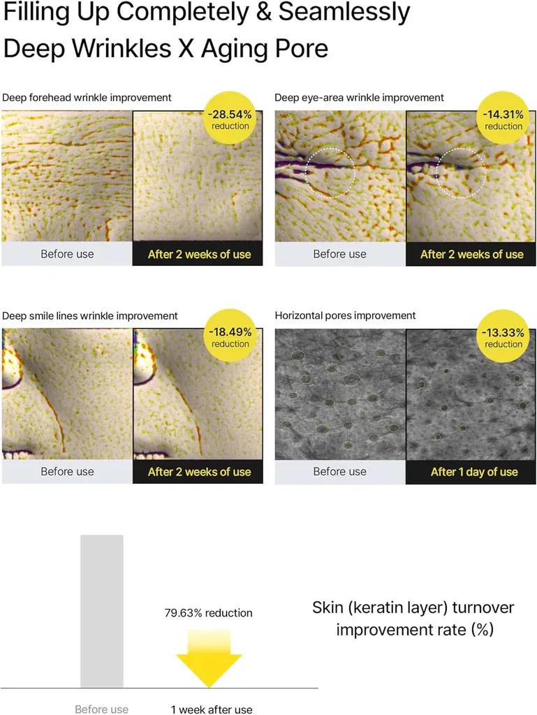 Cellimax Dead Skin Remover Cream for All Skin Types