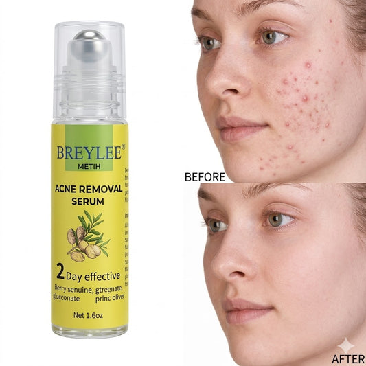 Temulawak - New Acne Removing Serum