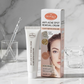Aichun Beauty Dark Spot Removal Cream – Dermatologist Recommended (20 g)